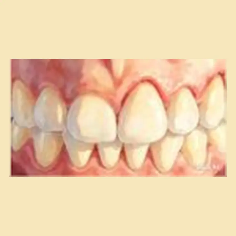 Exame cuidadoso da gengiva e dos dentes